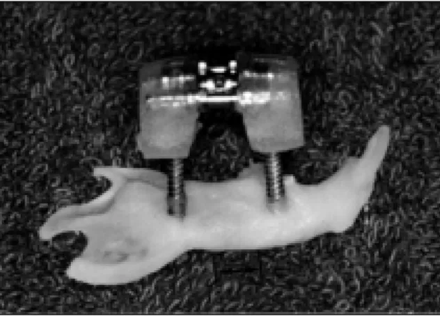 Fig. 4. Gross finding of excised mandible and device.