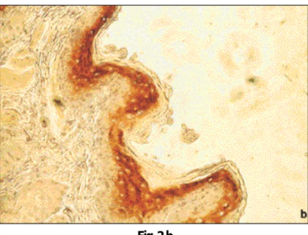 Fig. 2-bFig. 2-a