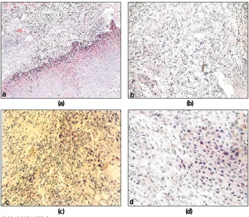 Fig. 1. Various type of invasion 