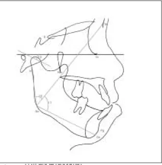 Fig. 2. Maxillomandibular positions