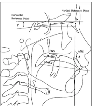 Fig 1. Construction  of  Horizontal  and  Vertical  Reference Planes