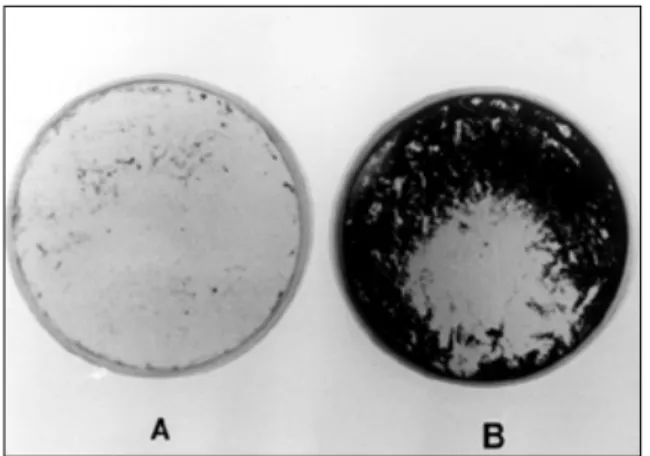 Fig. 1. Von Kossa 염색결과 모습. (A) 국소적으로 무기질이