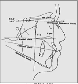 Fig. 1. Landmarks. Fig. 2. Reference planes.
