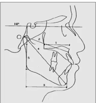 Fig. 3. Skeletal analysis-Vertical and horizontal measurements.