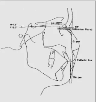 Fig. 1. Landmarks. Fig. 2. Reference planes.
