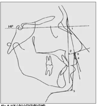Fig. 5. Angular measurements.