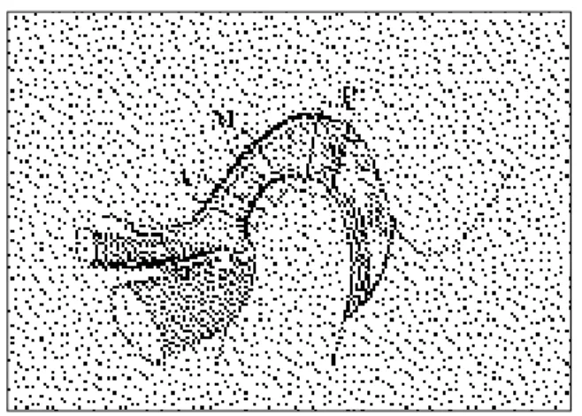 Fig. 1. Distraction device.