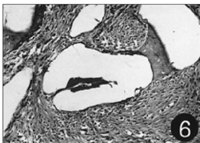 Fig. 5. The  dense  connective  tissues  are  filled  in  the  area  without bone  tissues