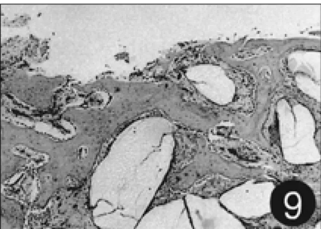 Fig. 10. The bone level is slightly decreased to concave shape due to constriction. Control group at 1 week after the graft
