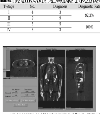 Fig. 1. Case  of  early  detection  in  intial  diagnosis.  The  whole  body FDG-PET scan shows high FDG uptake in right palate