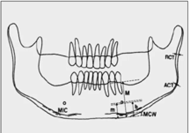 Fig. 1. Tracing of the panorama 