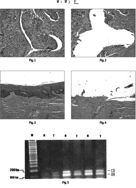 Fig. 1 Fig. 2