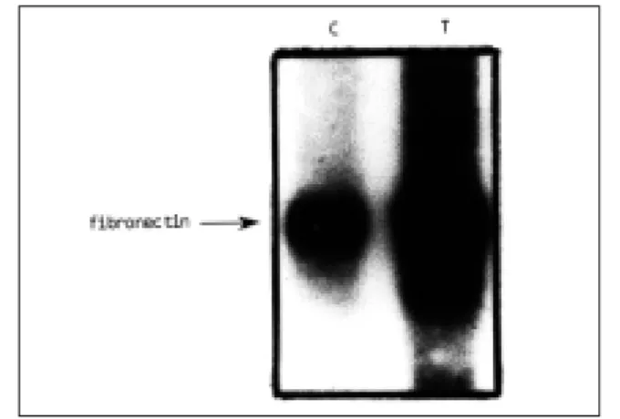 Fig. 5. Effects  of  APT  or  histamine  on  IP 3 generation  in  conrol cells( ) and transformed cells( ).