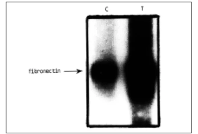 Fig. 5. Effects  of  APT  or  histamine  on  IP 3 generation  in  conrol cells( ) and transformed cells( ).