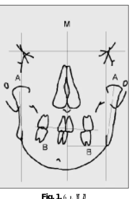 Fig. 1. 계측방법