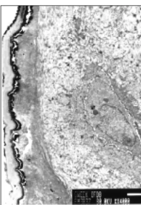 Fig. 26. 12th week of DFDB group (×100). The woven bone which is labeled diffusely with oxytetracycline, reduces remarkably