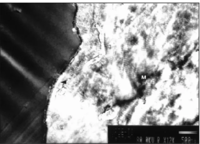 Fig. 30. 12th week of BMP group (×10000). Collagen fibrils extend to titanium coating without intervening layer.