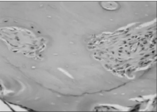 Fig. 4. Photomicrograph  of  6th  week  specimen  implanted  in  the  calf muscle  pouch  for  the  bioassay  of  DFDB  (H&amp;E,  ×100)