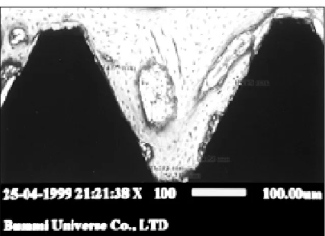 Fig. 9. Photograph of the analysis of the bone formation amount in the  fluoromicroscopic  finding  by  image  analysis  software(Bummi Universe  Co.)
