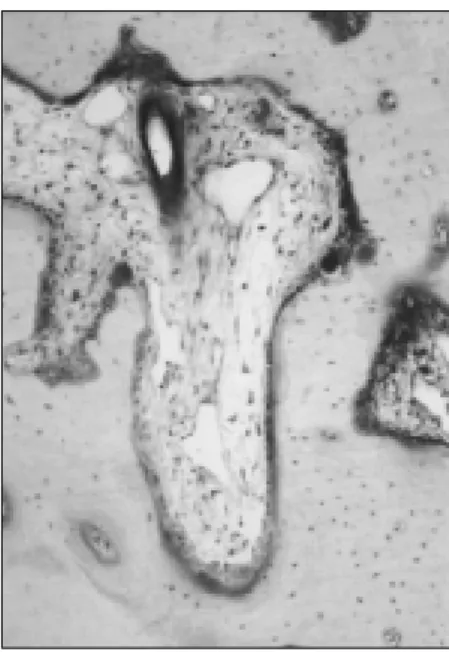 Fig. 24. 6th  week  of  DFDB  group  (×100).