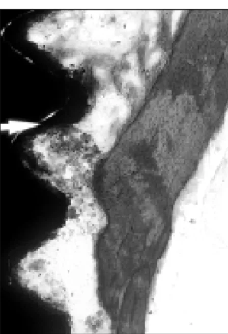 Fig. 6. 2nd  week  HA  implant  with  steroid  irrigation(×100).  Bone labelling of tetracycline layer was seen