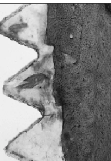 Fig. 8. 2nd  week  Ti  implant  group  with steroid irrigation(×100).