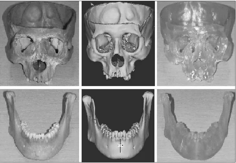 Fig. 2. 건조두개골, 3차원 영상 모델, RP 모형.