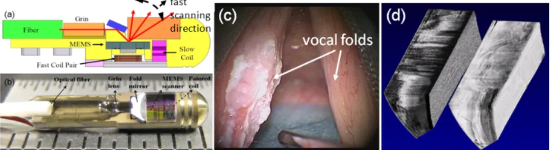 그림  1.  Human  vocal  fold  OCT  영상  장치  및  암질환  환자의  3차원  그림.  (a-b)  MEMS  scanning  catheter  개략도  및  실제그림