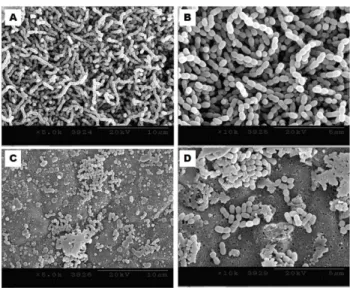 Fig. 5 − Field Emission-Scanning Electron Microscope of H. pylori cells not-treated (A, B) and treated with purified bee venom (C, D)