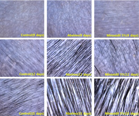 Fig.  3.  Appearance  of  dosal  skin  by  minoxidil  5%  in  male  C57BL/6  mice.  누어져  있으며  등의  피부에서  관찰된  모든  모낭 의  발육단계를  구별하여  나타냈다