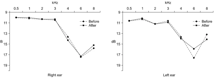 Fig.  3.  Mean  Audiometric  Threshold  Shifts  before  and  after  Vitamine  C  Intake.
