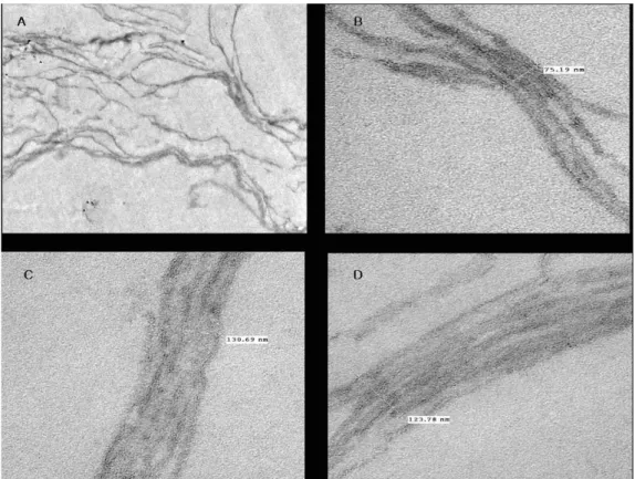 Fig  5.  TEM  photograpes  of  skin  analogue  membrane  having  a  lamella  LC  structure  :          A)  Overall  part  of  LC  structure(3,500(x)  Magnification), 