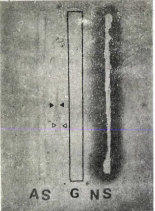 Fig.  5ᅳImmunoelectrophoretic  pattern  of  MBLA  lectin.