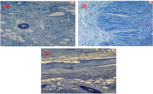 Fig. 3. The effects of cream containing a herb extracts mixed with Houttuynia cordata in DNCB-induced atopic dermatitis BALB/c mouse by microscopic comparision