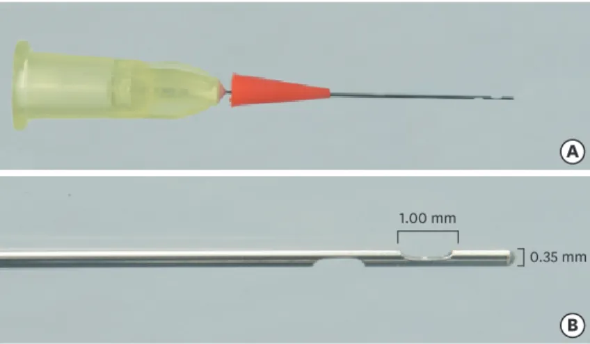 Figure 1.  Representation of the new Sealer Injection System (SIS) with side openings that should be threaded to  the Bio-C Sealer syringe for endodontic obturation (A), and the needle tip with more magnification (B).