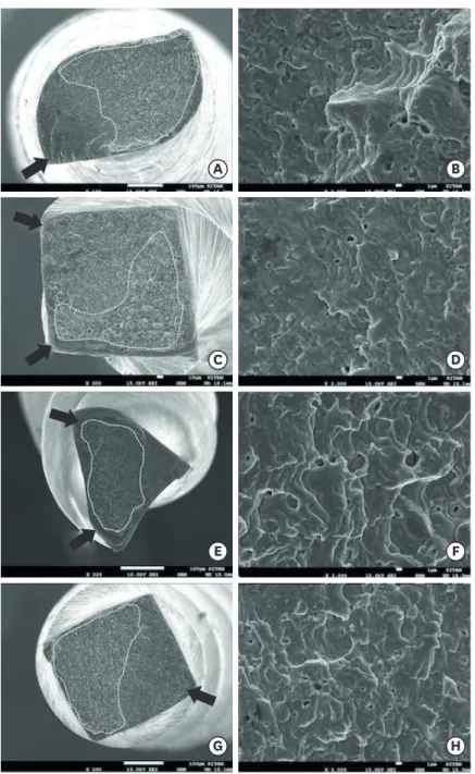 Figure 1.  The scanning electron microscope (SEM) images of the tested file's fractured surface