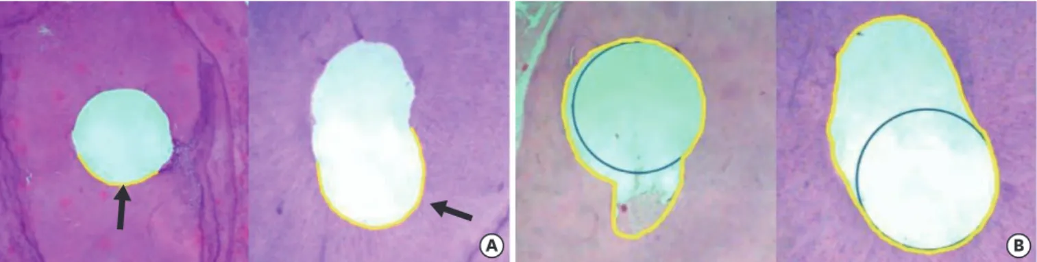 Figure 4.  Histological images used for the assessment of perimeter and area. (A) Representative images (×50) (hematoxylin and eosin) with touched perimeter  traced in yellow used to calculate touched/untouched perimeter ratio