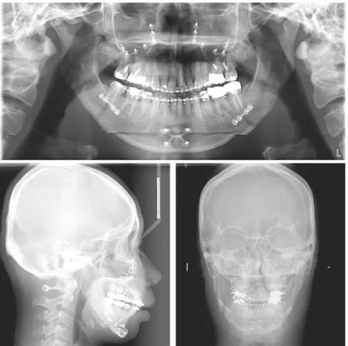 Figure 5.  Post-surgical  radiographs.
