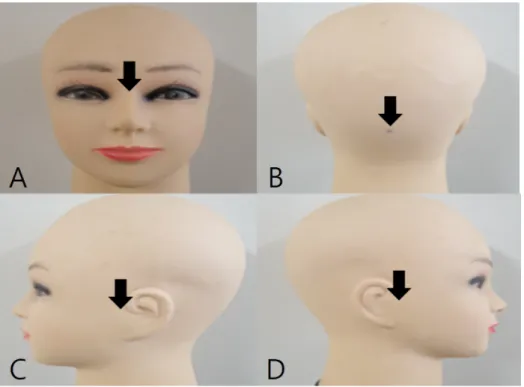 Figure 1.  The four reference points on  International 10∼20 electrode system.  (A)  Nasion