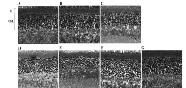 Fig. 2 − Morphologic evaluation by quantitative histology. Histogram show the average number of photoreceptor nuclei per 100 µm of ONL (A) and ONL thickness measured from the central retinas of mice (B)