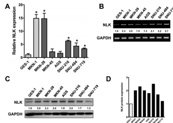 Fig. 3 − Expression of NLK in gastric cancer cell lines. (A) Endogenous expression level of NLK between human gastric mucosa and cancer cell lines by quantitative real-time reverse transcriptase PCR