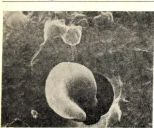 Fig.  1—Blood  pressure  of  each  group  at  7，10  and 14  weeks  after  birth.  Each  bar  indicates  Mean  土 SD  from  at  least  5  animals
