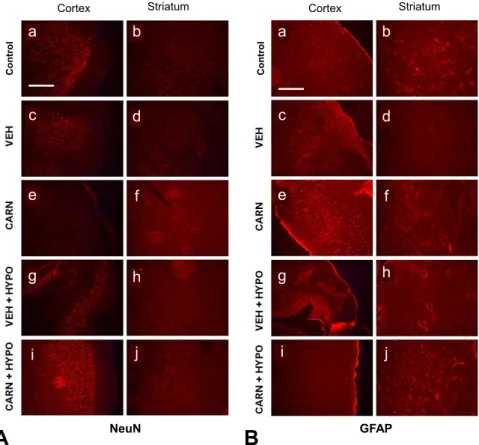 Fig. 5. Immunofluorescence findings of hypoxic-ischemic (HI) brain lesions in experimental rats