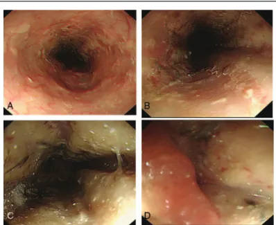 Figure 1. Computed tomography. There was no structural abnormality other than gastric distention.