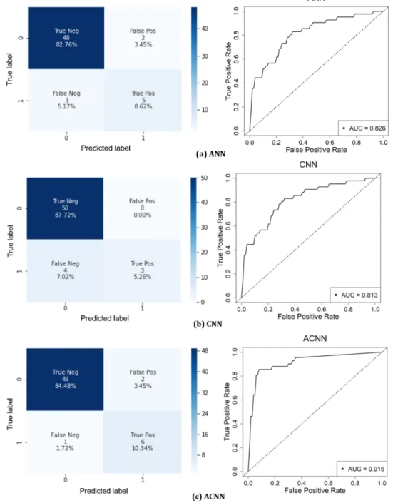 Figure  4 shows  the  ROC  curves  with  an  AUC  score  for  the ANN, CNN, and ACNN models during testing with the NCP lesion  data  set