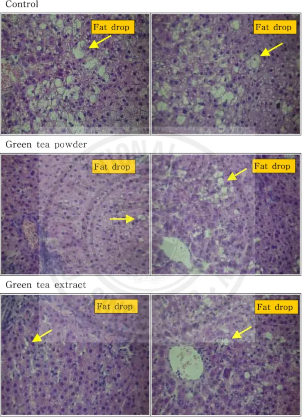 Figure  5.    Microscopic  appearance  of  liver  tissue  (×400)Fat  dropFat  dropFat  drop Fat  dropFat  drop Fat  drop