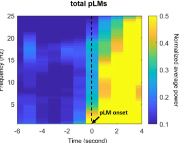 Figure 1.  Time-frequency maps of power near the pLMs. Power was averaged over all electroencephalographic  channels
