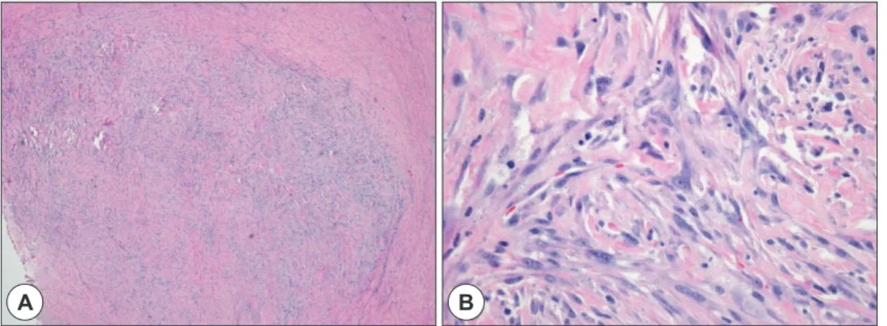 Fig. 2. Microscopic findings of low power field demonstrates hyercellularity (A: H&amp;E stain, ×40)