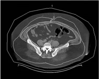 Fig. 1. How to calculate fat area on a computed tomography image. 