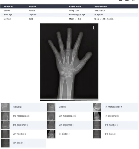 Table 4 shows the difference between the bone ages  from the reference standard and those obtained with the  BAA system